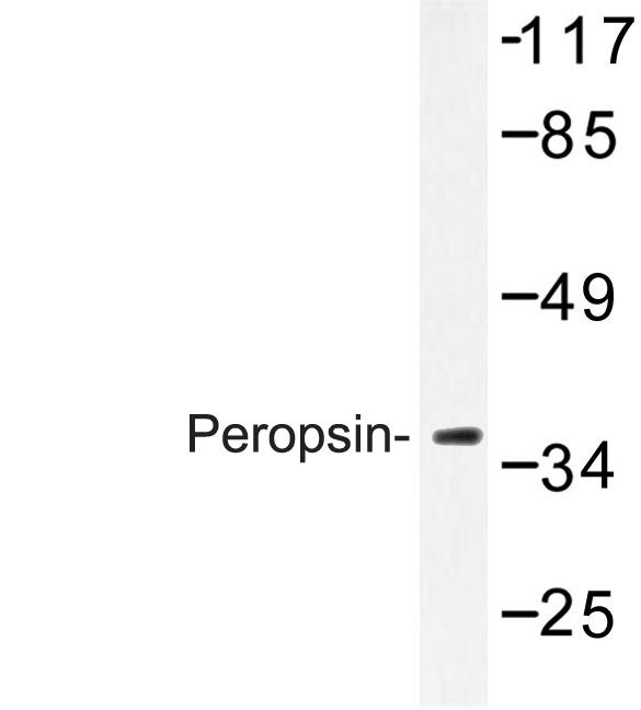 Western blot of Peropsin (D237) pAb in extracts from Jurkat/COLO cells.