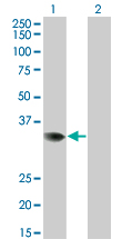 Western Blot analysis of PRPS2 expression in transfected 293T cell line by PRPS2 monoclonal antibody (M02), clone 4C1.Lane 1: PRPS2 transfected lysate(34.8 KDa).Lane 2: Non-transfected lysate.