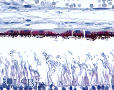 Anti-RRH / Peropsin antibody LS-A1150 IHC of human eye, pigmented retinal epithelium. Immunohistochemistry of formalin-fixed, paraffin-embedded tissue after heat-induced antigen retrieval.