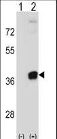 Western blot of PRPS2 (arrow) using rabbit polyclonal PRPS2 Antibody. 293 cell lysates (2 ug/lane) either nontransfected (Lane 1) or transiently transfected (Lane 2) with the PRPS2 gene.