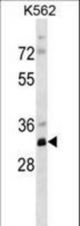 PRPS2 Antibody western blot of K562 cell line lysates (35 ug/lane). The PRPS2 antibody detected the PRPS2 protein (arrow).