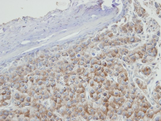 IHC of paraffin-embedded Hep3B xenograft using PRPS2 antibody at 1:100 dilution.