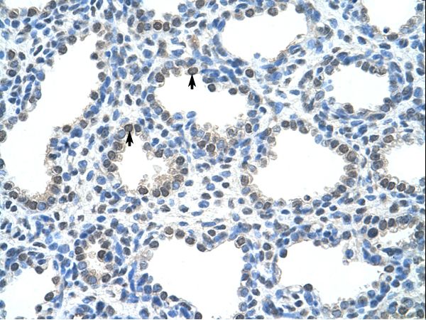 PIR / Pirin antibody LS-C31789 was used in IHC to stain formalin-fixed, paraffin-embedded human lung.