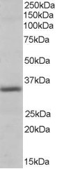 Antibody (0.3 ug/ml) staining of Human Heart lysate (35 ug protein in RIPA buffer). Primary incubation was 1 hour. Detected by chemiluminescence.