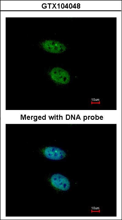 Immunofluorescence of paraformaldehyde-fixed HeLa using PRPS2 antibody at 1:200 dilution.