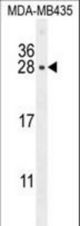 CSH1 Antibody western blot of MDA-MB435 cell line lysates (35 ug/lane). The CSH1 antibody detected the CSH1 protein (arrow).