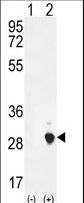 Western blot of CSH1 (arrow) using rabbit polyclonal CSH1 Antibody. 293 cell lysates (2 ug/lane) either nontransfected (Lane 1) or transiently transfected (Lane 2) with the CSH1 gene.