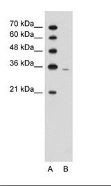 A: Marker, B: Jurkat Cell Lysate