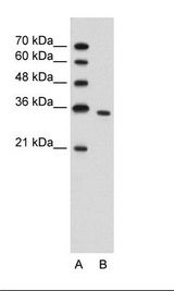 A: Marker, B: Jurkat Cell Lysate