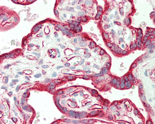 Human Placenta: Formalin-Fixed, Paraffin-Embedded (FFPE)