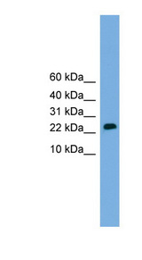 CSH2 antibody LS-C116486 Western blot of Placenta lysate.