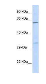 PRPS2 antibody LS-C110637 Western blot of 721_B cell lysate.