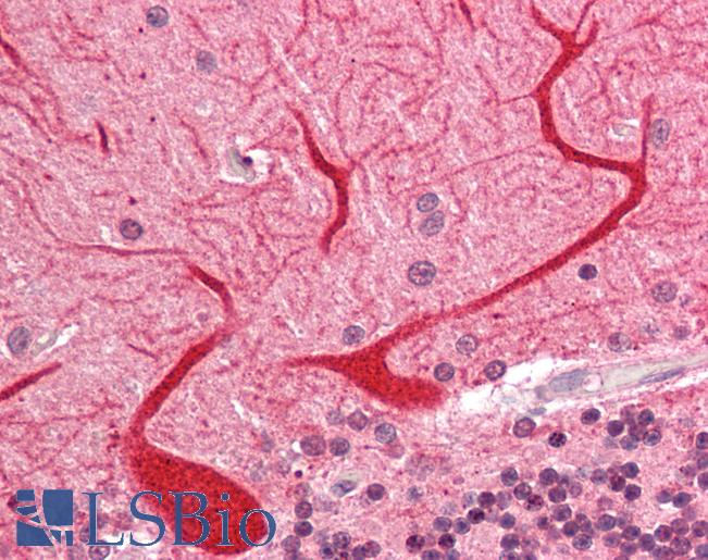 Human Brain, Cerebellum: Formalin-Fixed, Paraffin-Embedded (FFPE)