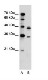 A: Marker, B: Jurkat Cell Lysate