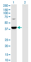 Western Blot analysis of PRPSAP1 expression in transfected 293T cell line by PRPSAP1 monoclonal antibody (M01), clone 5H10.Lane 1: PRPSAP1 transfected lysate (Predicted MW: 39.4 KDa).Lane 2: Non-transfected lysate.