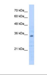 HepG2 cell lysate. Antibody concentration: 0.5 ug/ml. Gel concentration: 12%.