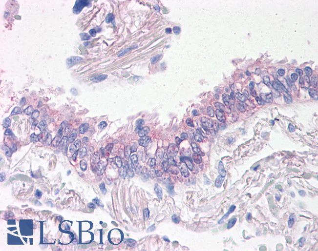 Anti-PROM2 antibody LS-A9230 IHC of human lung, respiratory epithelium. Immunohistochemistry of formalin-fixed, paraffin-embedded tissue after heat-induced antigen retrieval.