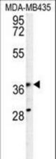 KPRA Antibody western blot of MDA-MB435 cell line lysates (35 ug/lane). The KPRA antibody detected the KPRA protein (arrow).