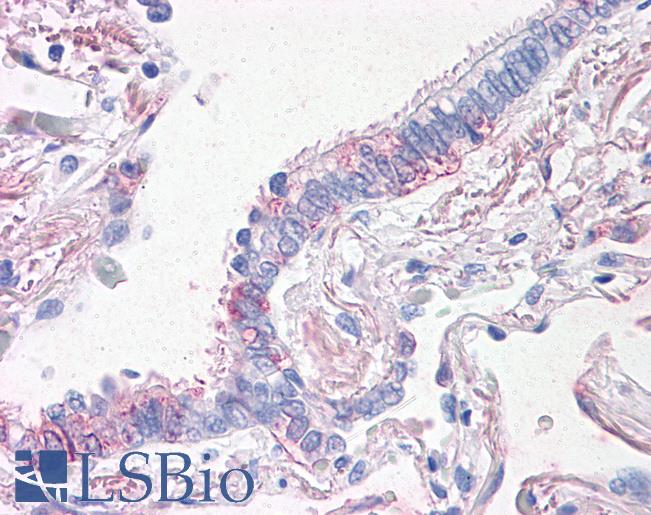 Anti-PROM2 antibody LS-A9227 IHC of human lung, respiratory epithelium. Immunohistochemistry of formalin-fixed, paraffin-embedded tissue after heat-induced antigen retrieval.