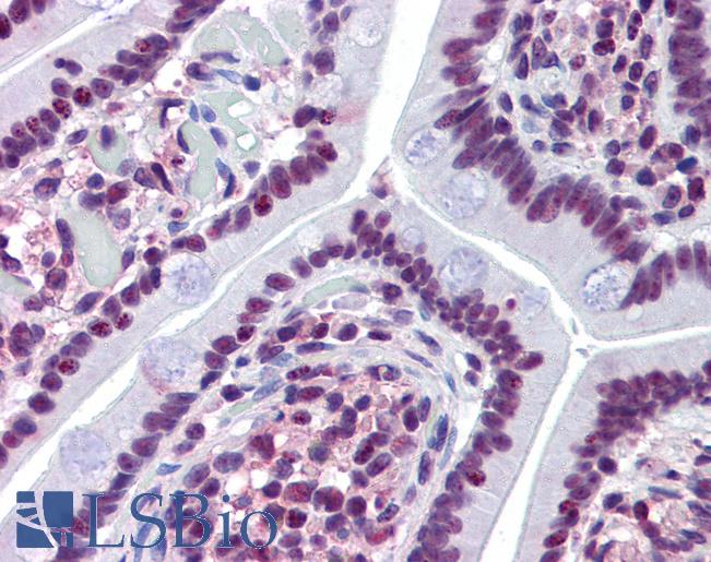 Anti-PROM2 antibody LS-A9927 IHC of human small intestine. Immunohistochemistry of formalin-fixed, paraffin-embedded tissue after heat-induced antigen retrieval.