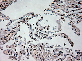 IHC of paraffin-embedded lung tissue using anti-PROM2 mouse monoclonal antibody. (Dilution 1:50).
