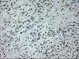 IHC of paraffin-embedded Ovary tissue using anti-PROM2 mouse monoclonal antibody. (Dilution 1:50).