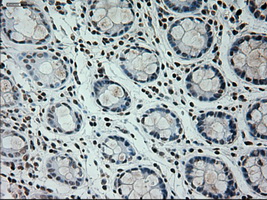 IHC of paraffin-embedded colon tissue using anti-PROM2 mouse monoclonal antibody. (Dilution 1:50).
