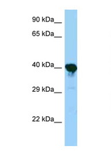 PRPSAP1 antibody LS-C146281 Western blot of Mouse Kidney lysate. Antibody concentration 1 ug/ml.