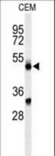 Western blot of CFP Antibody in CEM cell line lysates (35 ug/lane). CFP (arrow) was detected using the purified antibody.