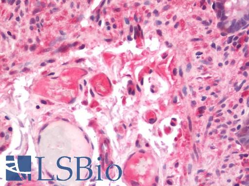 Human Colon: Formalin-Fixed, Paraffin-Embedded (FFPE)