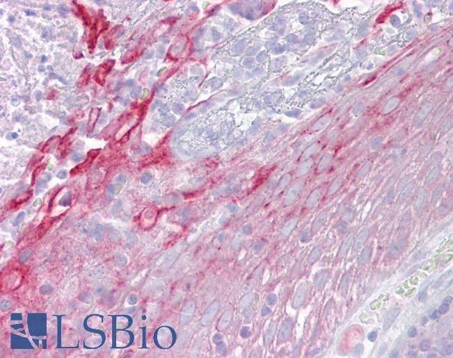 Anti-CFP / Properdin antibody IHC of human tonsil. Immunohistochemistry of formalin-fixed, paraffin-embedded tissue after heat-induced antigen retrieval. Antibody LS-B6914 concentration 5 ug/ml.