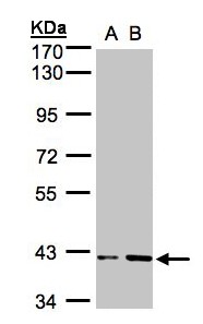 Sample (30g whole cell lysate). A: HeLa S3, B: Hep G2 . 10% SDS PAGE. PRPSAP1 antibody diluted at 1:1000