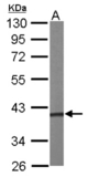 Sample (50 ug of whole cell lysate). A: mouse liver. 10% SDS PAGE. PRPSAP1 antibody diluted at 1:1000.