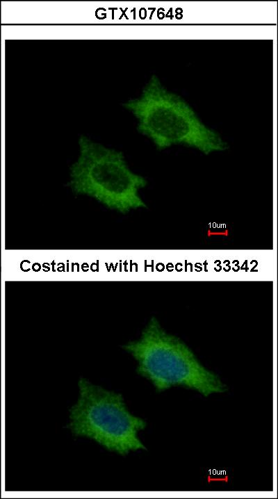 Immunofluorescence of methanol-fixed HeLa using PRPSAP2 antibody at 1:500 dilution.