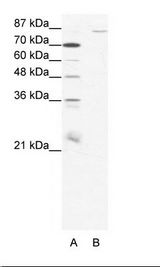 A: Marker, B: HepG2 Cell Lysate
