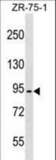 MEFV Antibody western blot of ZR-75-1 cell line lysates (35 ug/lane). The MEFV antibody detected the MEFV protein (arrow).