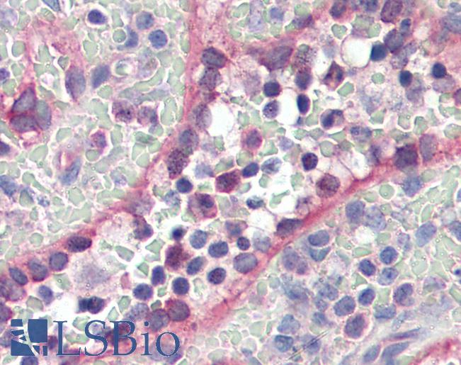 Anti-MEFV antibody IHC of human spleen. Immunohistochemistry of formalin-fixed, paraffin-embedded tissue after heat-induced antigen retrieval. Antibody LS-B865 concentration 10 ug/ml.