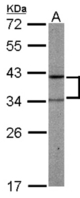Sample (50 ug of whole cell lysate). A: mouse liver. 12% SDS PAGE. PRPSAP2 antibody diluted at 1:1000.