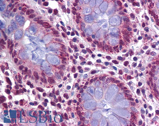 Anti-KPNA4 antibody IHC of human colon. Immunohistochemistry of formalin-fixed, paraffin-embedded tissue after heat-induced antigen retrieval. Antibody LS-B5342 concentration 5 ug/ml.