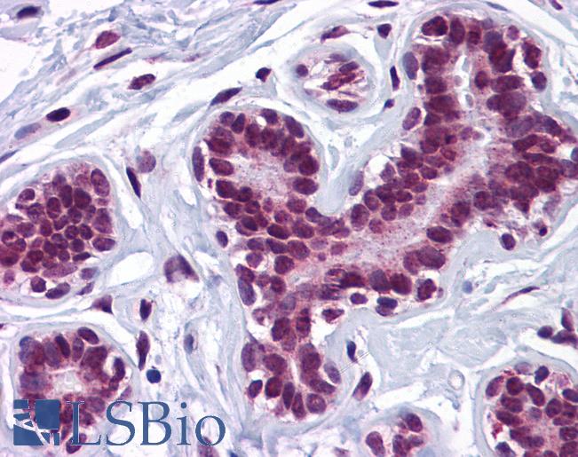 Anti-KPNA4 antibody IHC of human breast. Immunohistochemistry of formalin-fixed, paraffin-embedded tissue after heat-induced antigen retrieval. Antibody LS-B5342 concentration 5 ug/ml.