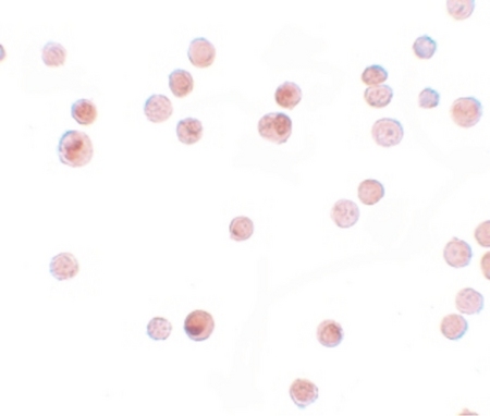 Immunocytochemistry of KPNA4 in HeLa cells with KPNA4 antibody at 2.5 ug/ml.