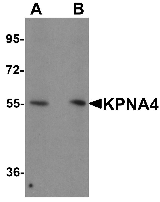 Western blot analysis of KPNA1 in HeLa cell lysate with KPNA1 antibody at 1ug/ml.