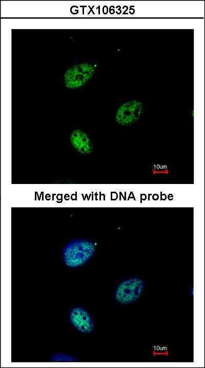 Immunofluorescence of paraformaldehyde-fixed HeLa using QIP1 antibody at 1:200 dilution.
