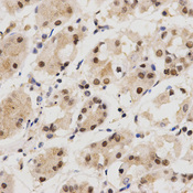 Immunohistochemistry of paraffin-embedded human stomach tissue using KPNA4 antibody at dilution of 1:200 (x400 lens).