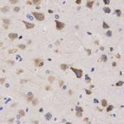 Immunohistochemistry of paraffin-embedded rat brain tissue using KPNA4 antibody at dilution of 1:200 (x400 lens).