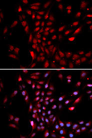 Immunofluorescence analysis of U2OS cell using KPNA4 antibody. Blue: DAPI for nuclear staining.