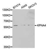 Western blot analysis of extracts of various cell lines, using KPNA4 antibody.