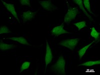 Immunostaining analysis in HeLa cells. HeLa cells were fixed with 4% paraformaldehyde and permeabilized with 0.1% Triton X-100 in PBS. The cells were immunostained with anti-KPNA4 mAb.