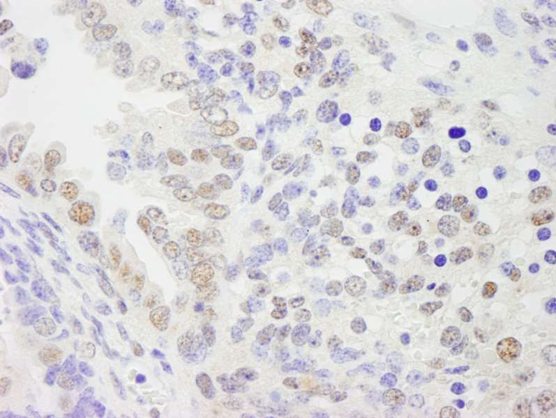 Detection of Mouse KPNA4 by Immunohistochemistry. Sample: FFPE section of mouse teratoma. Antibody: Affinity purified rabbit anti-KPNA4 used at a dilution of 1:250.