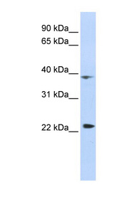 PRR11 antibody LS-C102377 Western blot of HepG2 cell lysate.